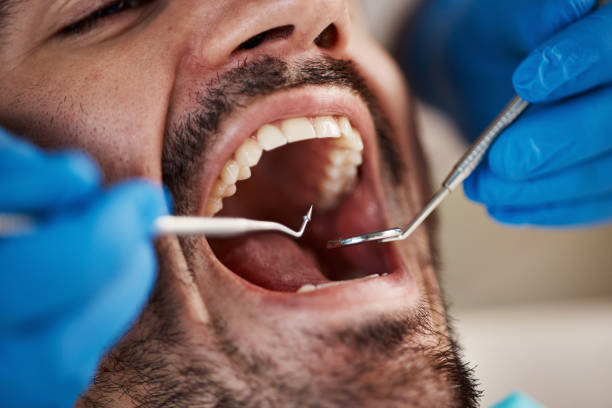 Best Laser Dentistry  in Duncan Falls, OH